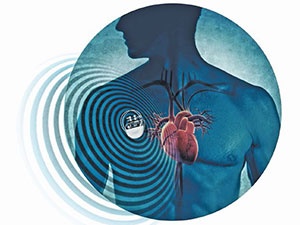 heartbeat_300_01